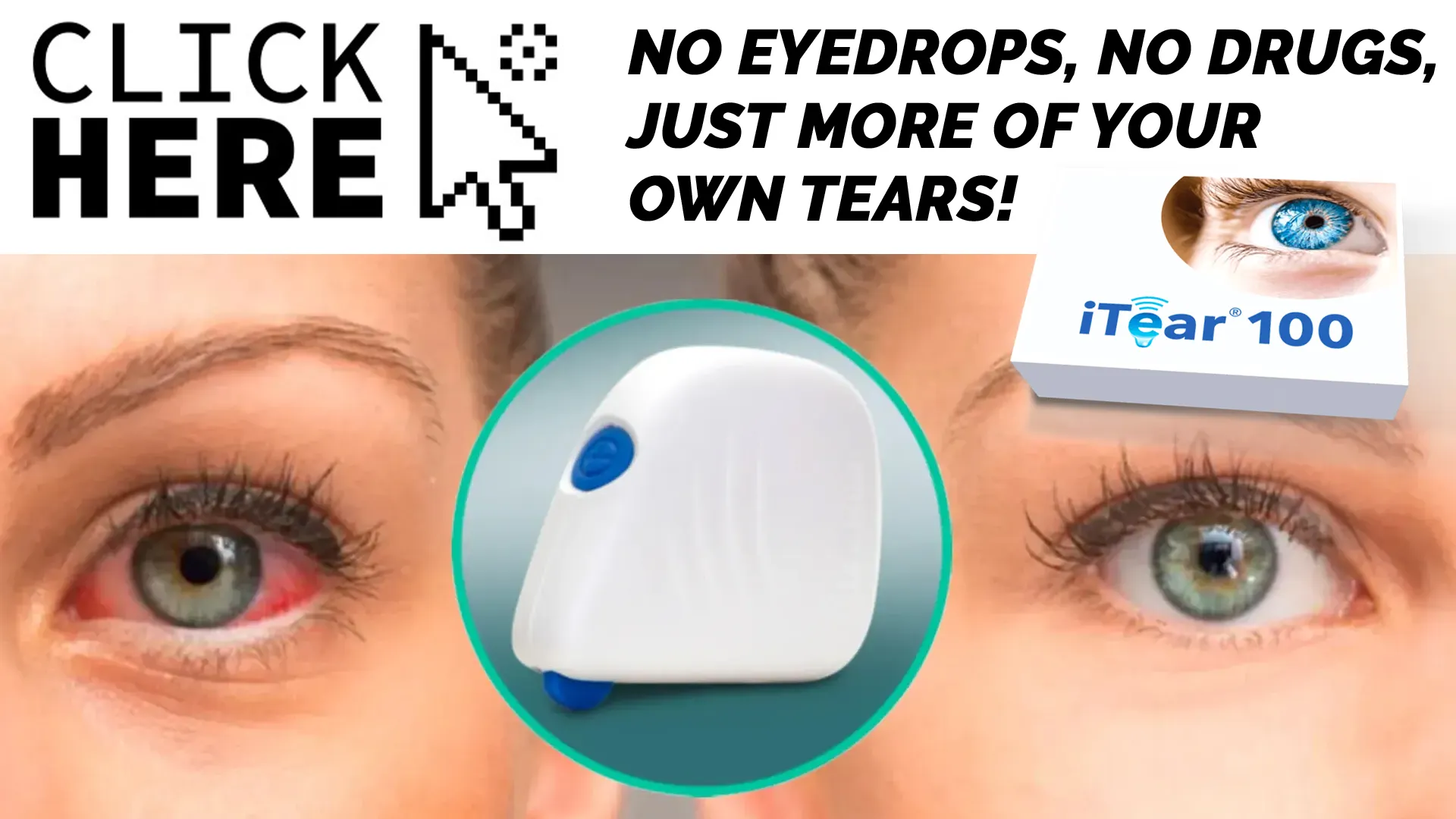Advantages of iTear100 Over Traditional Eye Drops